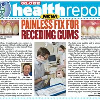 Pinhole Gum Rejuvenation for patients